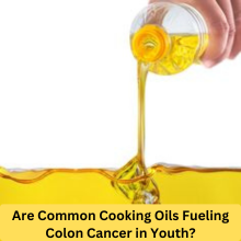 Cooking Oils