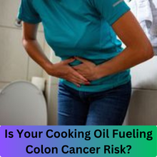 Colon Cancer