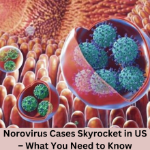 Norovirus